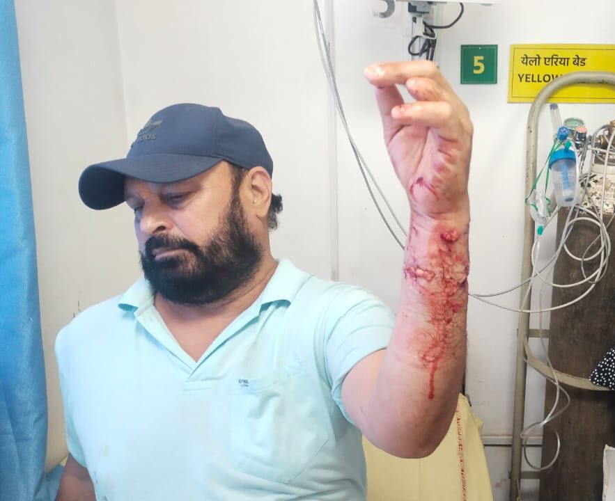 पालतू कुत्ते का खूंखार हमला: युवक को घर में घुसकर बुरी तरह नोचा; सब्जी वाले पर भी किया जानलेवा वार, मालिक पर FIR दर्ज